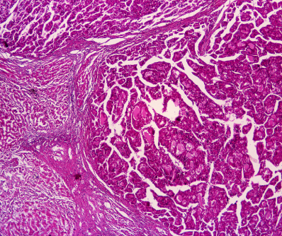 Pierre-Fabre-R&D-Oncology-Biotherapy