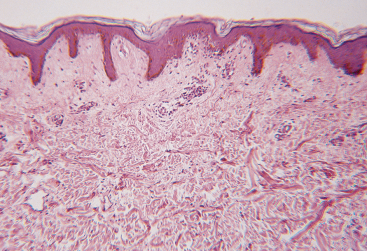 Pierre Fabre R&D Dermatology - Skin