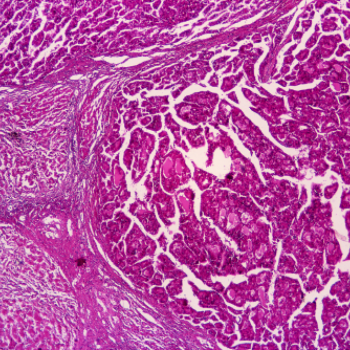 Pierre-Fabre-R&D-Oncology-Biotherapy